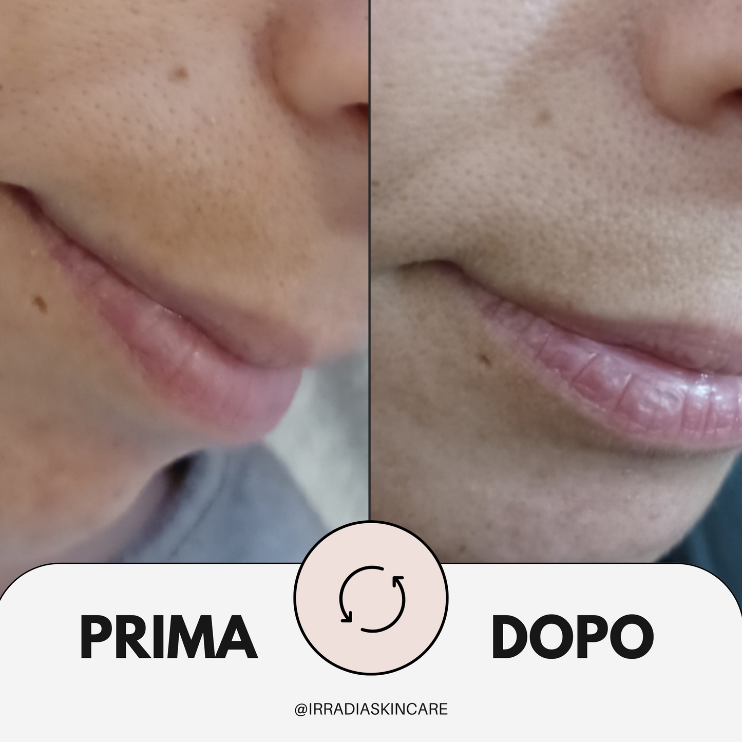 CLARA - Siero Depigmentante 30 ml