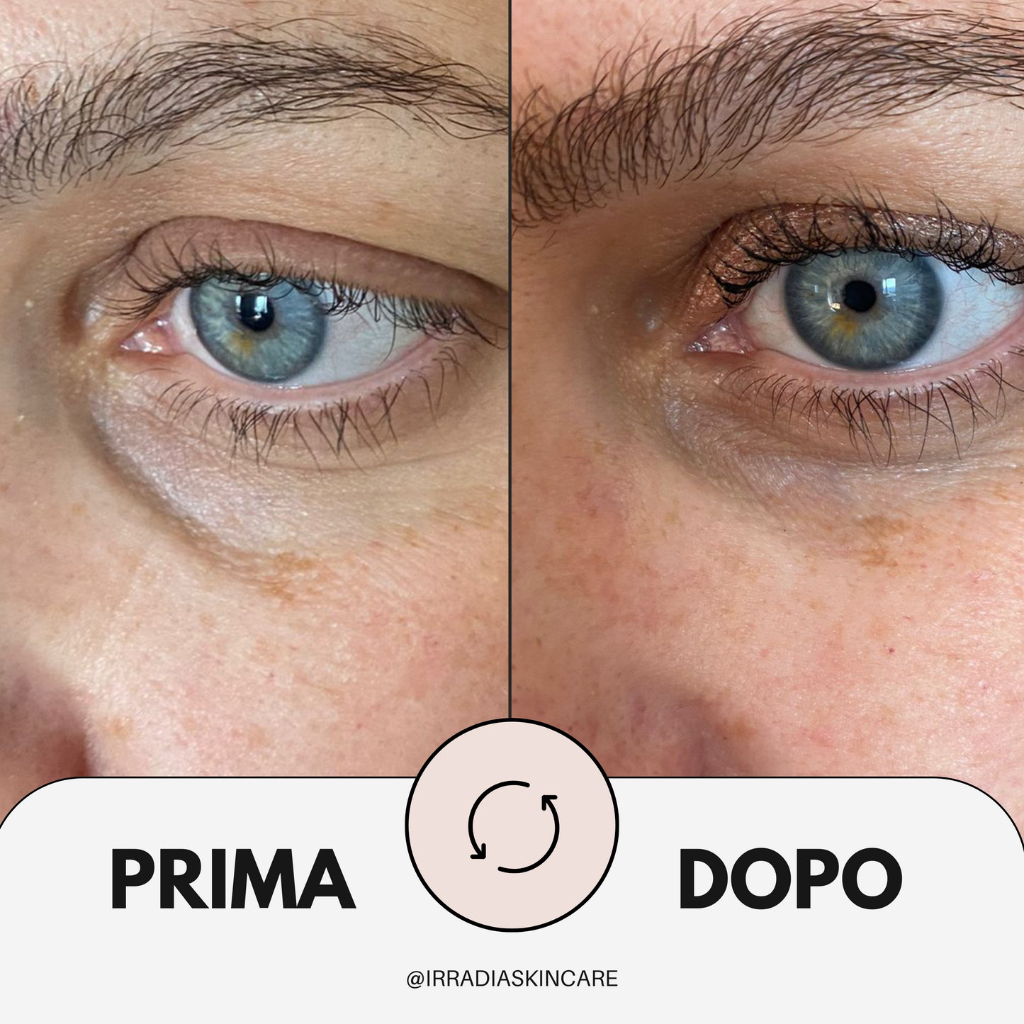 LINEAMENTA - Contorno Occhi/Labbra 15 ml