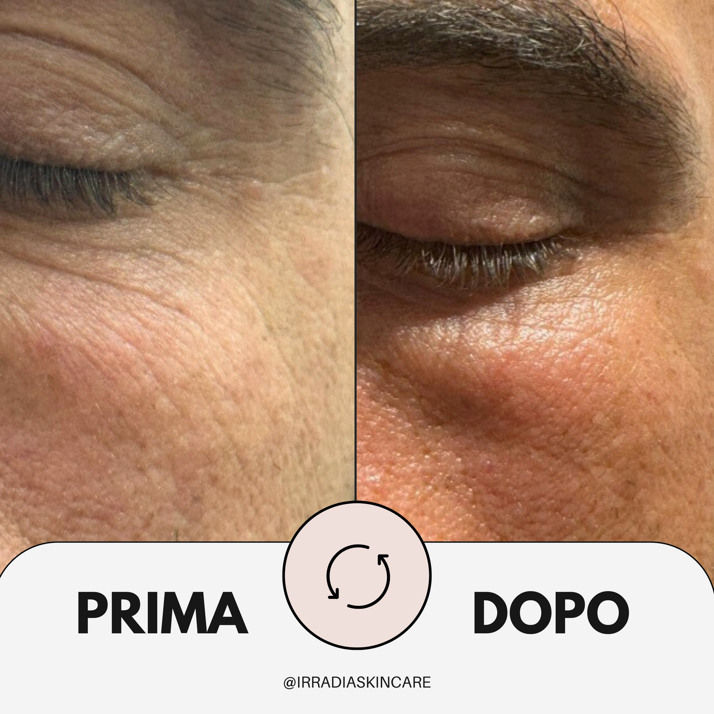 LUMIA - Siero Iper Idratante 30 ml