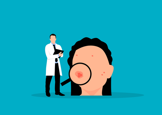 ACNE: comprendere e non aggredire...