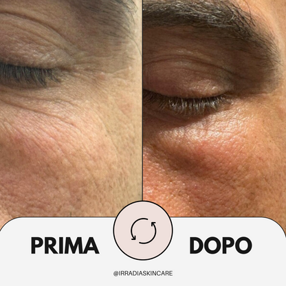 LUMIA -  Siero Iper Idratante  30 ml